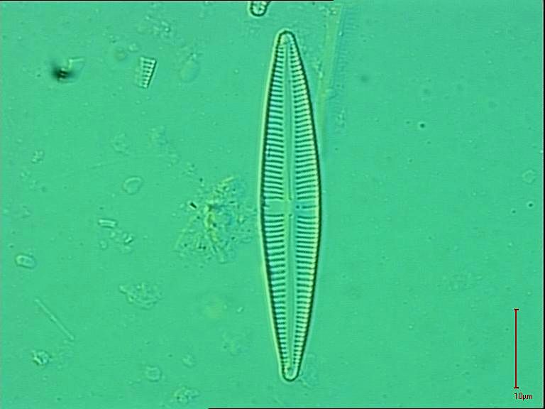 Gomphonema acidoclinatum, Lange-Bertalot & E. Reichardt, 2004 | Sandre 